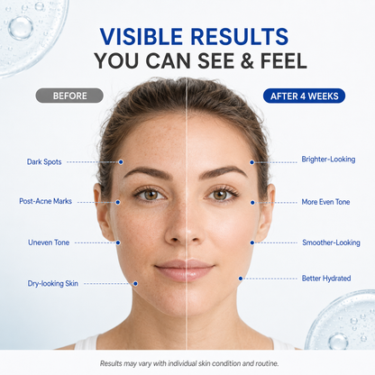 TRANEXAMIC ACID + VITAMINC