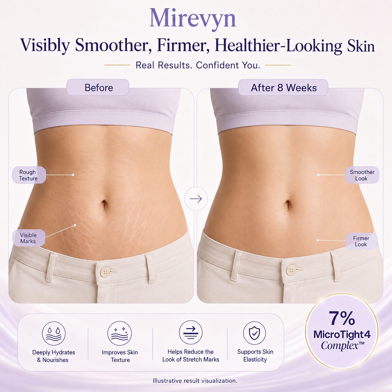 Tighten & Smooth Belly Cream