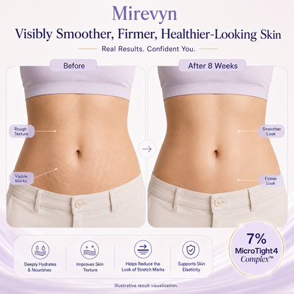 Tighten & Smooth Belly Cream